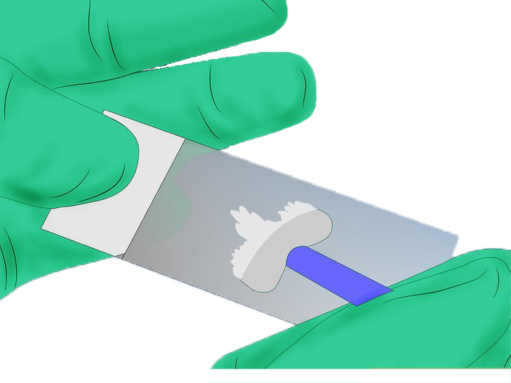 Pap Smear
